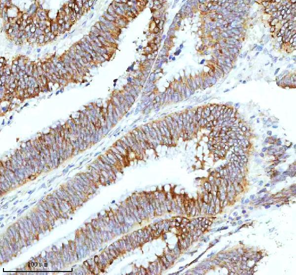 a08943 1 hagh primary antibodies ihc testing 5