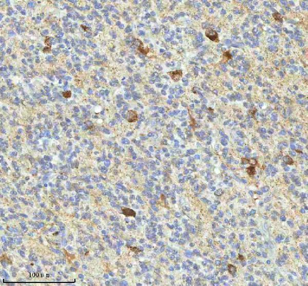 a08943 1 hagh primary antibodies ihc testing 7