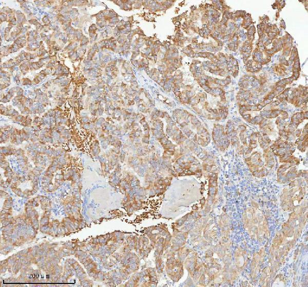 a08943 1 hagh primary antibodies ihc testing 8