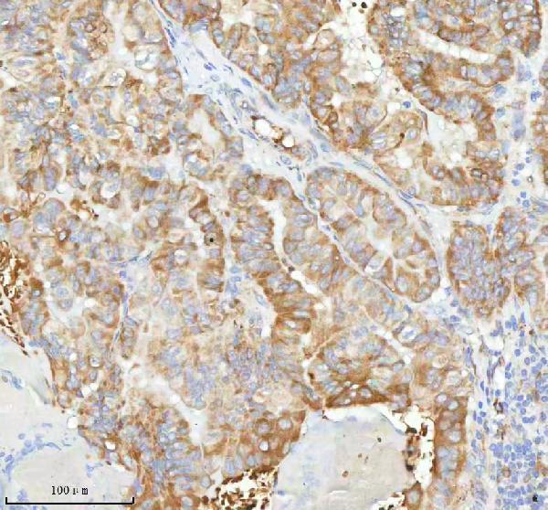a08943 1 hagh primary antibodies ihc testing 9