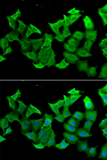 Immunofluorescence analysis of A549 cells using HAGH antibody 