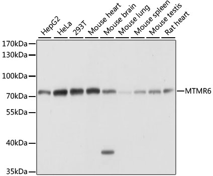Western blot analysis of extracts of various cell lines, using MTMR6 antibody  at 1:1000 dilution