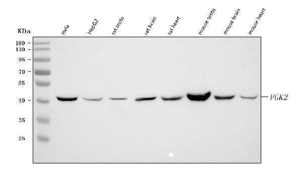 Western blot analysis of PGK2 using anti-PGK2 antibody (A08946-1)