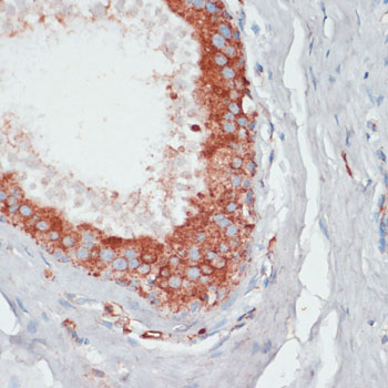 a08946 pgk2 primary antiboties ihc testing 2