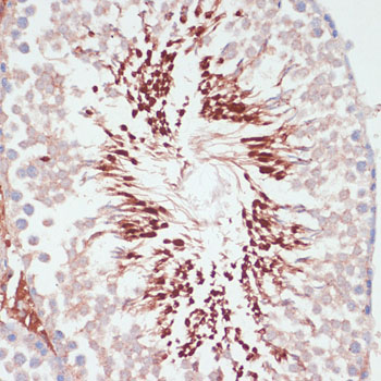 a08946 pgk2 primary antiboties ihc testing 3
