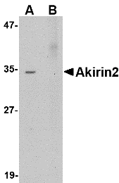 Western blot analysis of Akirin2 in Human Brain tissue lysate with Akirin2 antibody at 0