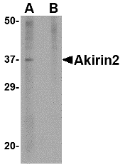 Western blot analysis of Akirin2 in mouse brain tissue lysate with Akirin2 antibody at 1 μg/mL in (A) the absence and (B) the presence of blocking peptide