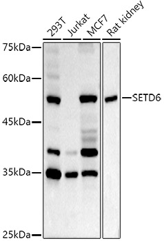 Western blot analysis of extracts of various cell lines, using SETD6 antibody  at  1:1000 dilution