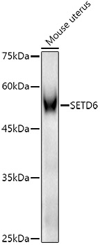 Western blot analysis of extracts of Mouse uterus, using SETD6 antibody  at  1:1000 dilution
