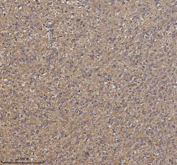  IHC analysis of TRIM2 using anti-TRIM2 antibody (A08957)