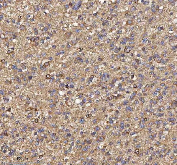  IHC analysis of TRIM2 using anti-TRIM2 antibody (A08957)