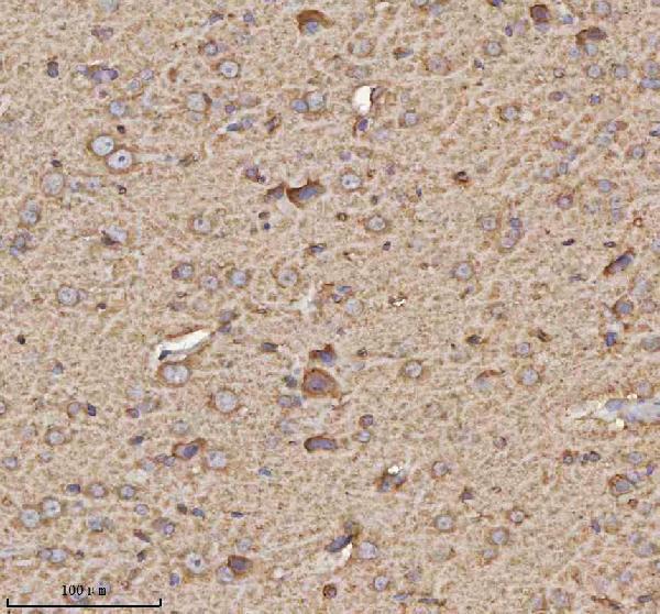 a08957 trim2 primary antibodies ihc testing 5