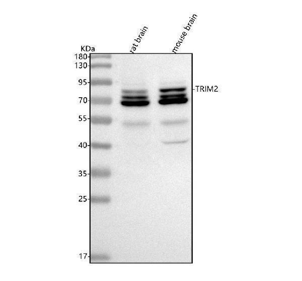  Western blot analysis of TRIM2 using anti-TRIM2 antibody (A08957)