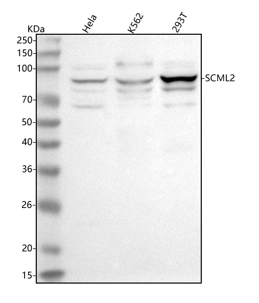  Western blot analysis of SCML2 using anti-SCML2 antibody (A08958-1)
