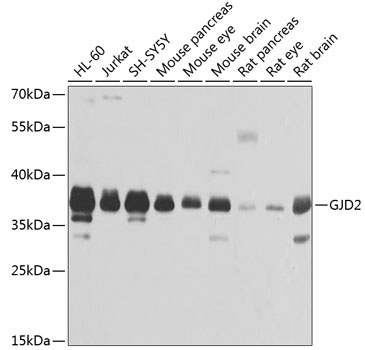 Western blot analysis of extracts of various cell lines, using GJD2 antibody  at 1:1000 dilution