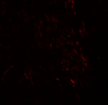a08961 zmym3 primary antibodies if testing 2