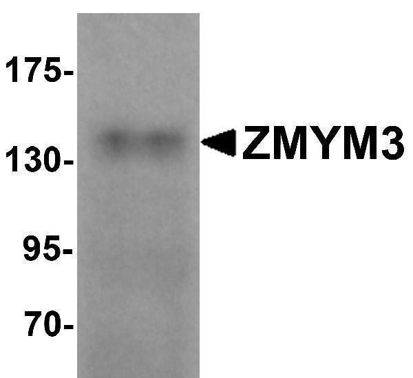 a08961 zmym3 primary antibodies wb testing 1
