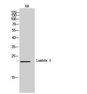 Western Blot analysis of KB cells using Lambda 5 Polyclonal Antibody