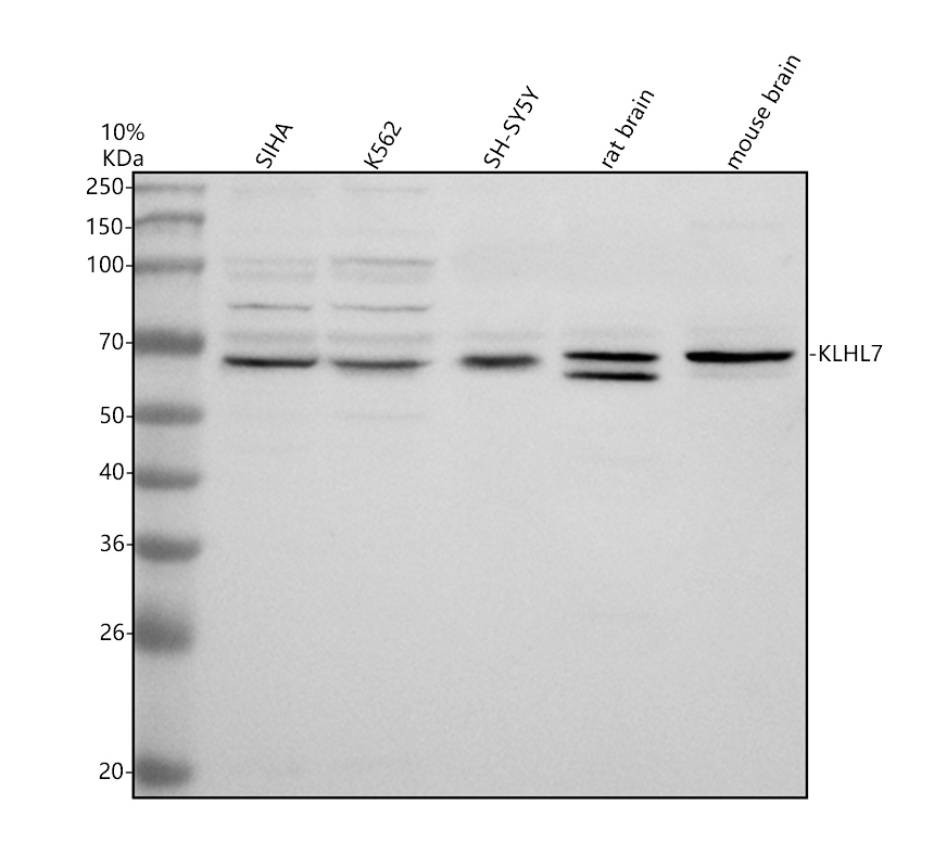 Western blot analysis of KLHL7 using anti-KLHL7 antibody (A08968-2)