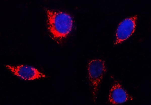  IF analysis of PITRM1 using anti-PITRM1 antibody (A08969-1)