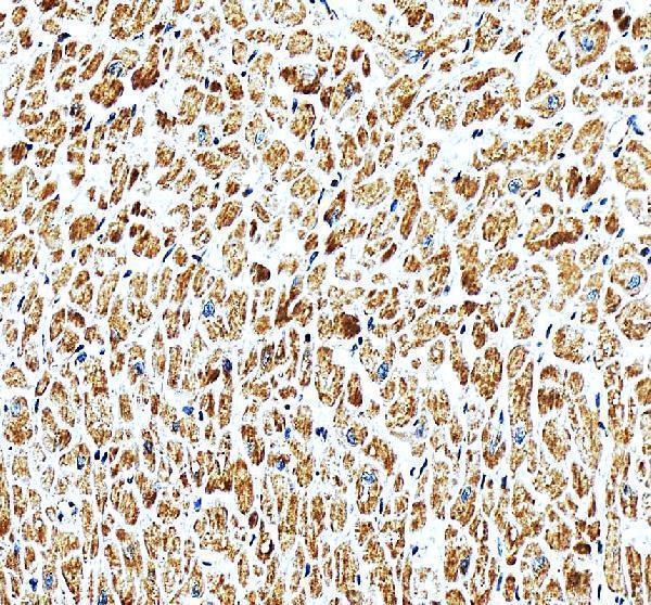 IHC analysis of PITRM1 using anti-PITRM1 antibody (A08969-1)