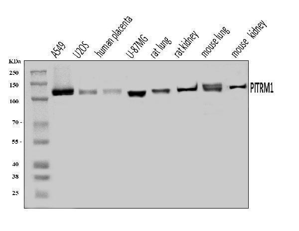  Western blot analysis of PITRM1 using anti-PITRM1 antibody (A08969-1)