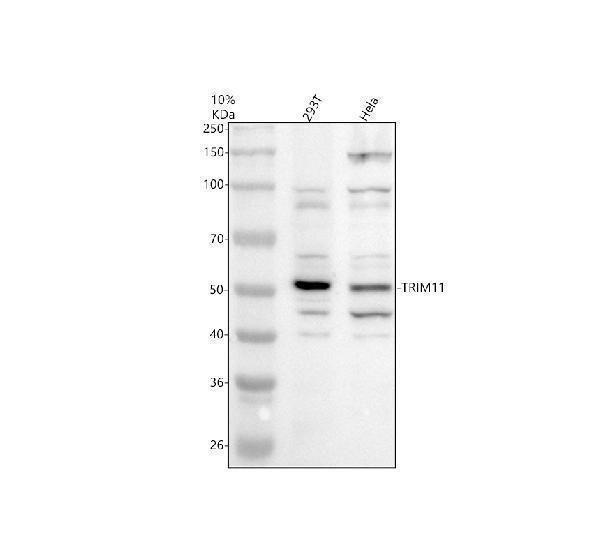 Western blot analysis of TRIM11 using anti-TRIM11 antibody (A08971-2)