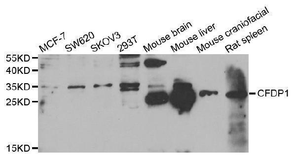 WesternBlot (WB) analysis of CFDP1 polyclonal antibody