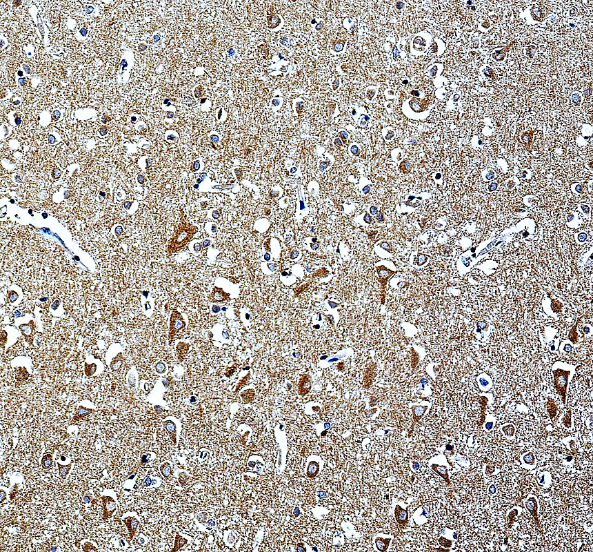 IHC analysis of LIAS using anti-LIAS antibody (A08974-1)