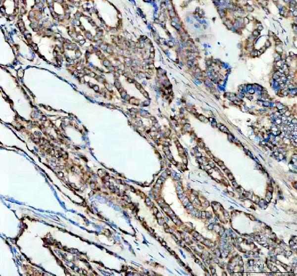 a08974 1 lias primary antibodies ihc testing 3