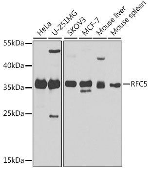 a08976 rfc5 primary antiboties wb testing 1