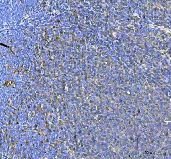  IHC analysis of SAMSN1 using anti-SAMSN1 antibody (A08977-2)