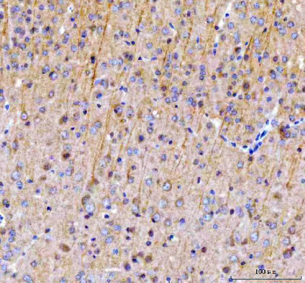  IHC analysis of SAMSN1 using anti-SAMSN1 antibody (A08977-2)