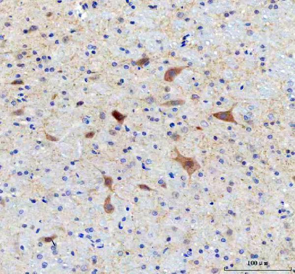 a08977 2 samsn1 primary antibodies ihc testing 4