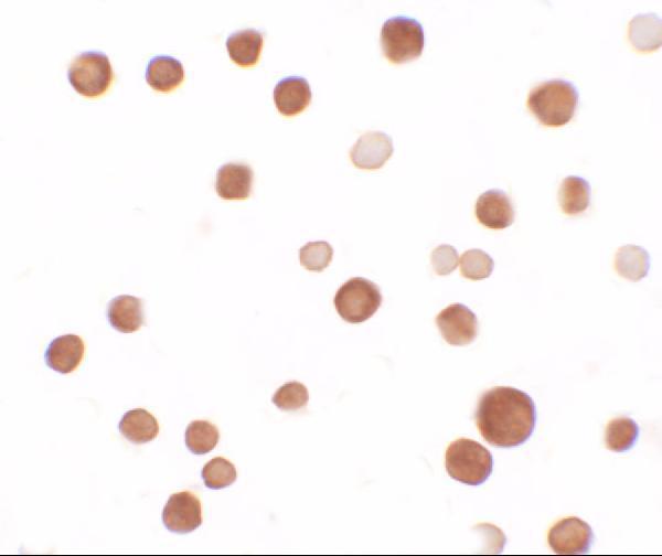 Immunocytochemistry of SAMSN1 in HeLa cells with SAMSN1 antibody at 2