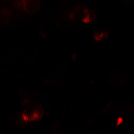 Immunofluorescence of SAMSN1 in HeLa cells with SAMSN1 antibody at 5 μg/ml