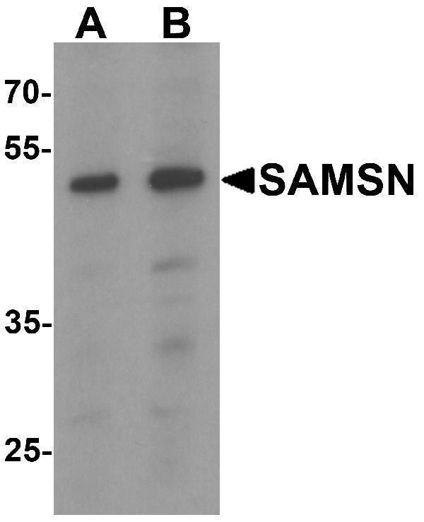 Western blot analysis of SAMSN in Hela cell lysate with SAMSN antibody at (A) 0