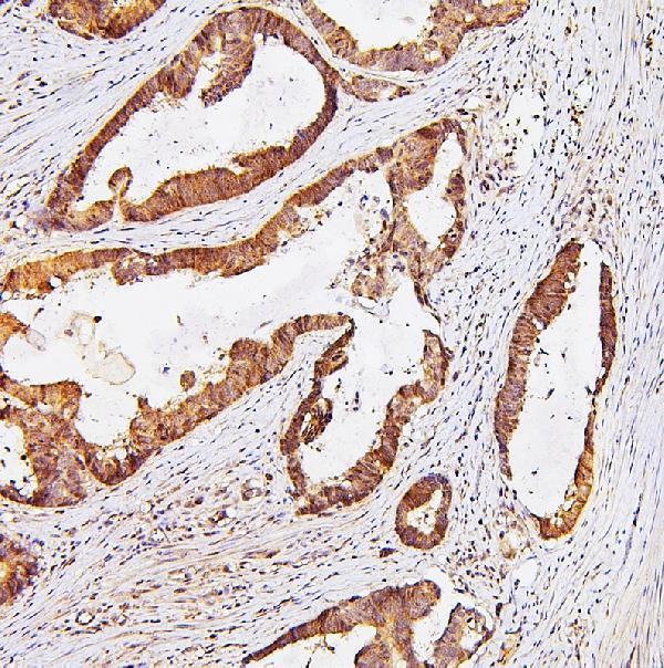 a08978 tdrd3 primary antibodies ihc testing 3