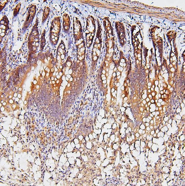 a08978 tdrd3 primary antibodies ihc testing 5