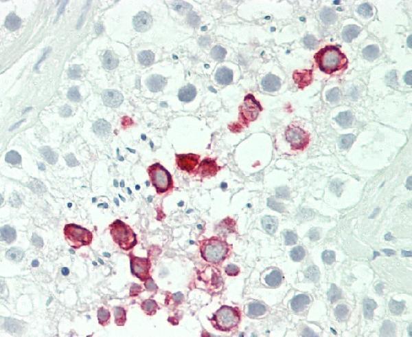 a08980 1 anti ifna4 antibody c term ihc p testing 2