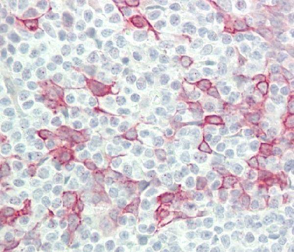 a08980 1 anti ifna4 antibody c term ihc p testing 3
