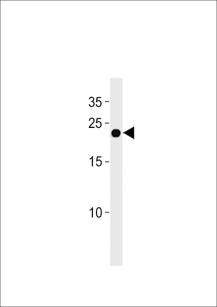 IFNA4 Antibody (C-term) western blot analysis in U937 cell line lysates (35ug/lane).This demonstrates the IFNA4 antibody detected the IFNA4 protein (arrow).