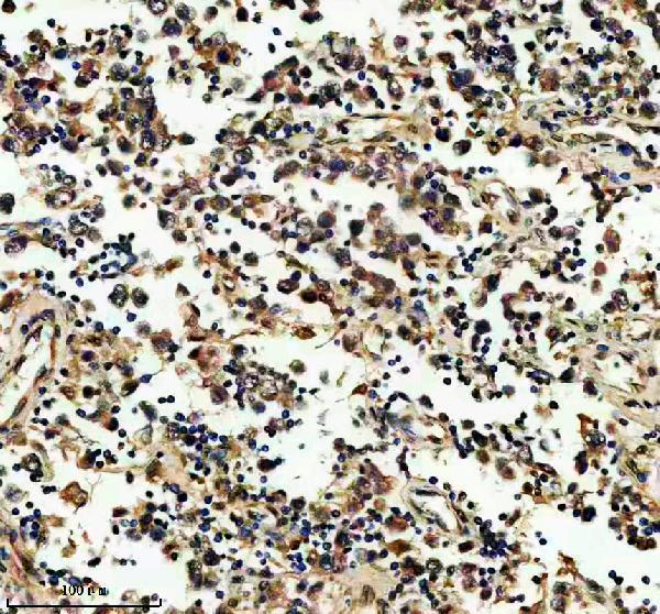 a08984 exoc3 primary antibodies ihc testing 1