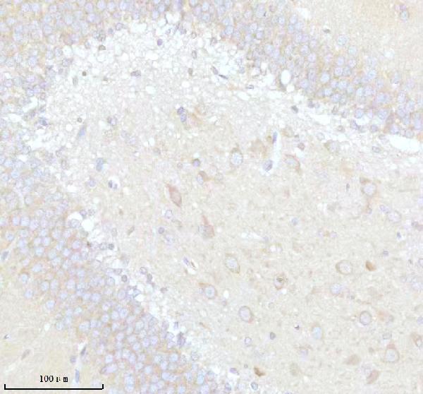 a08984 exoc3 primary antibodies ihc testing 2