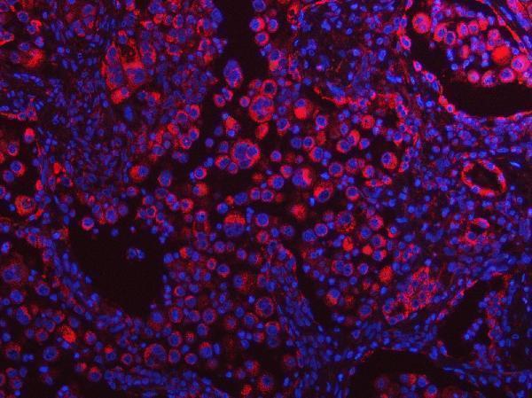 a08988 1 plekha1 primary antibodies if testing 8