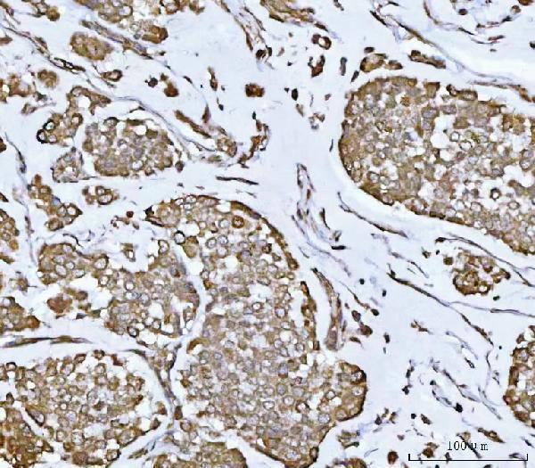  IHC analysis of PLEKHA1 using anti-PLEKHA1 antibody (A08988-1)