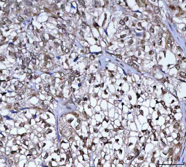  IHC analysis of PLEKHA1 using anti-PLEKHA1 antibody (A08988-1)