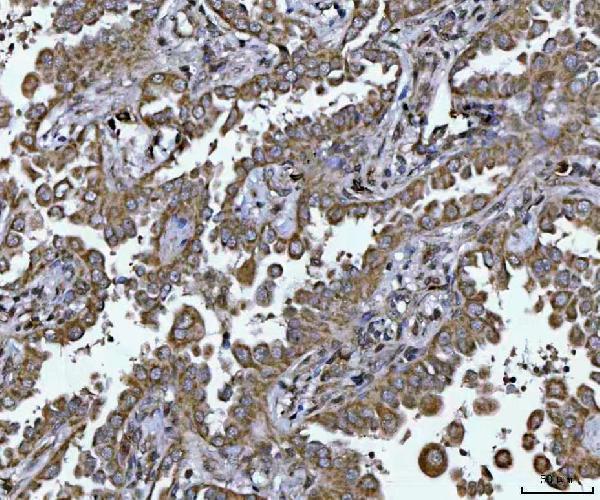 a08988 1 plekha1 primary antibodies ihc testing 4