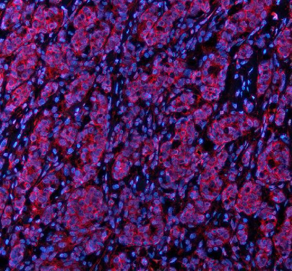 a08994 2 stxbp3 primary antibodies if testing 1