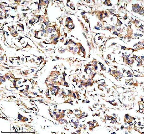 IHC analysis of STXBP3 using anti-STXBP3 antibody (A08994-2)